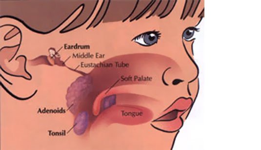 tonsils and adenoid