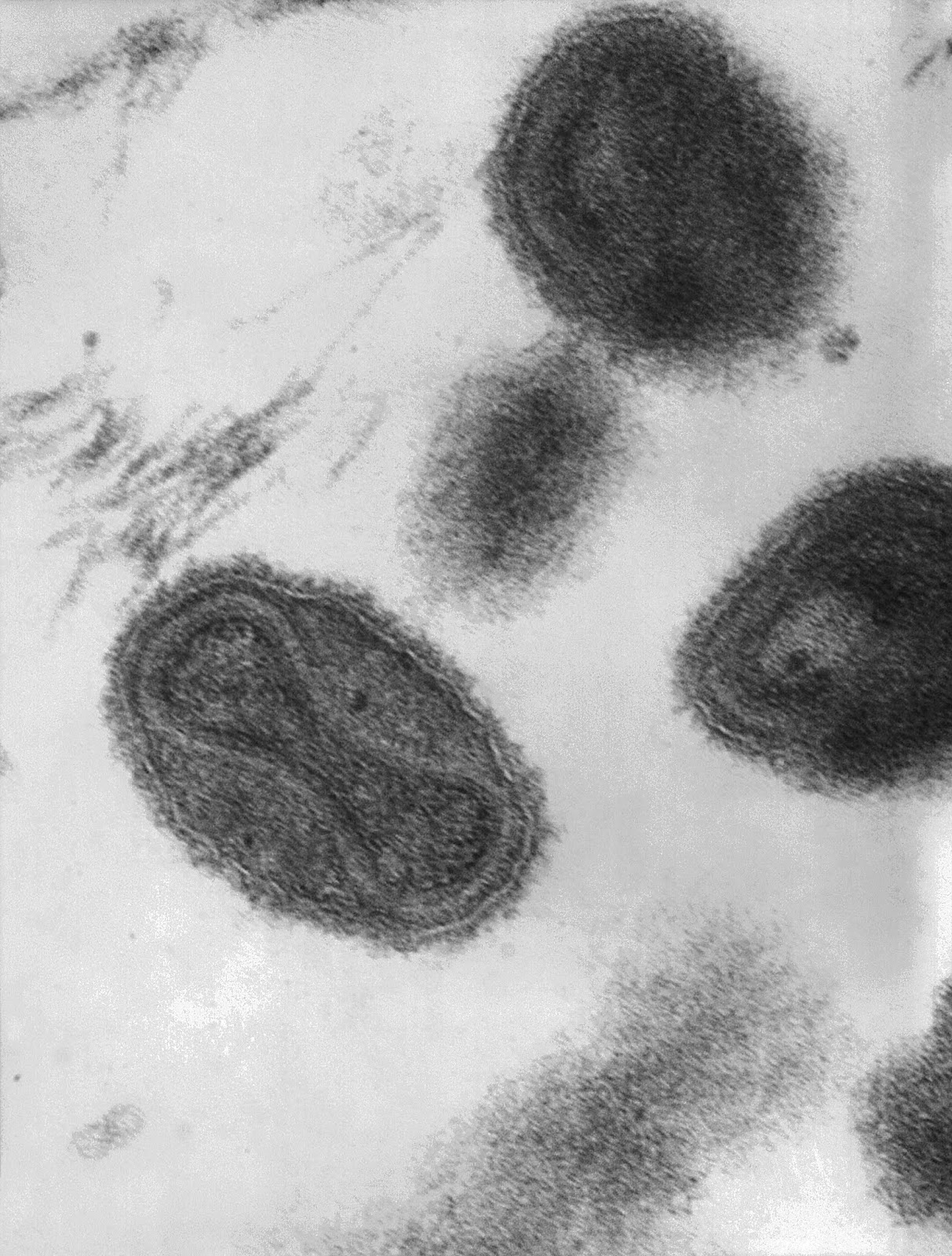 Smallpox_virus_virions_TEM_PHIL_1849.jpeg