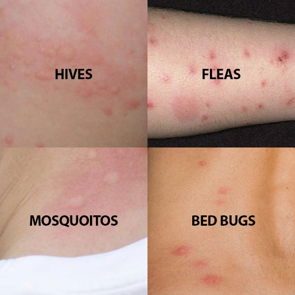 bites-collage.jpg