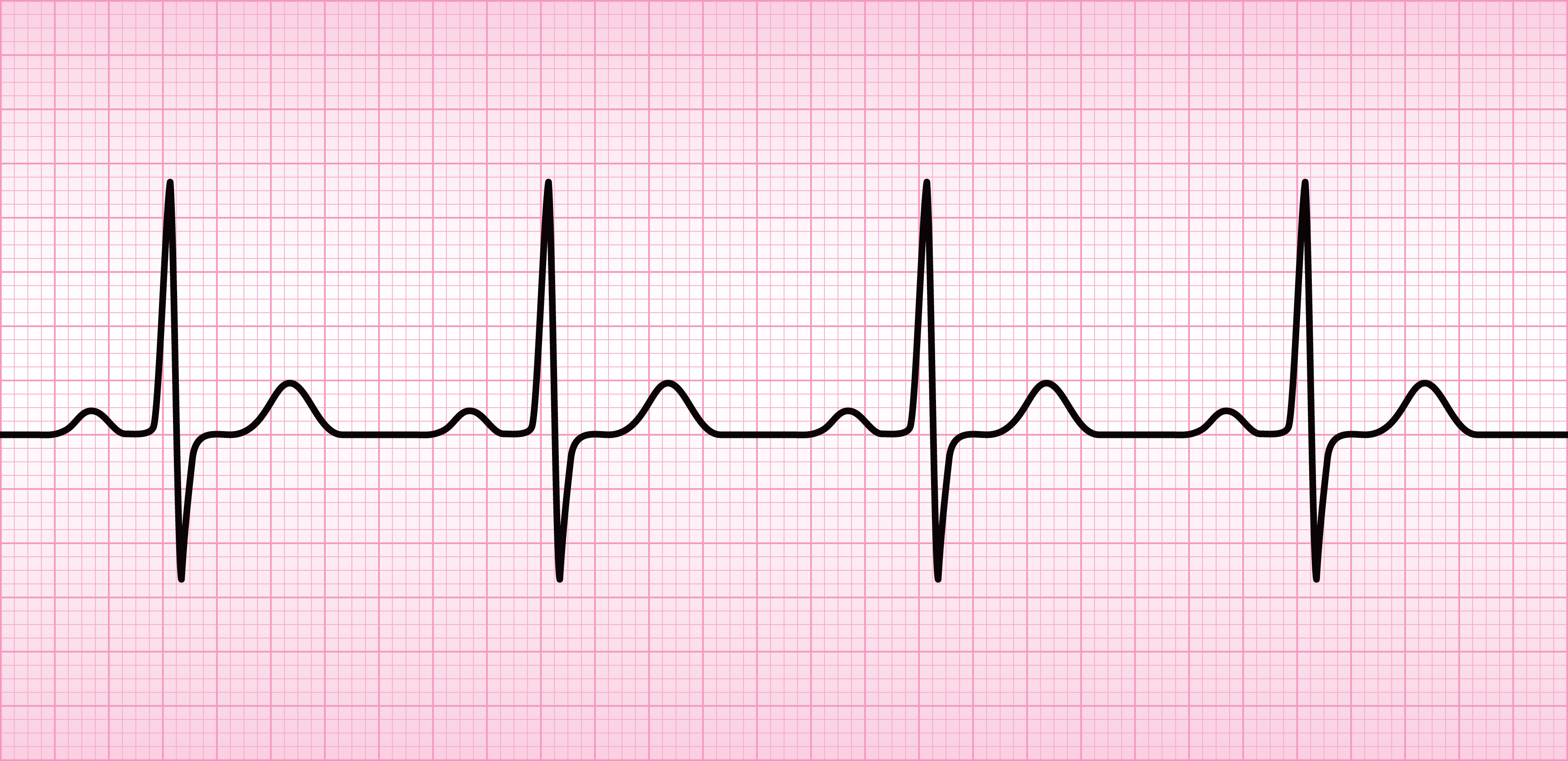 фото здоровой кардиограммы сердца