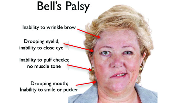 bels.jpg