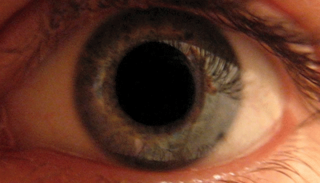 eye_dilate1.gif