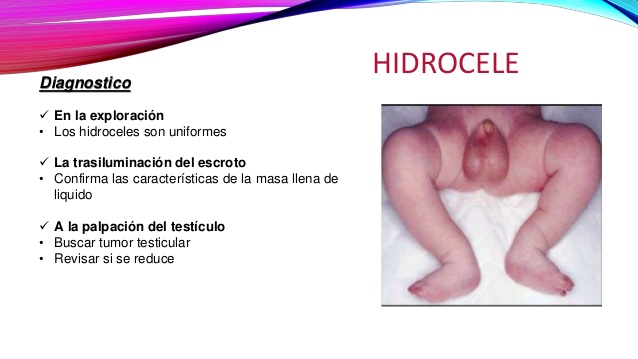 hidro4.jpg