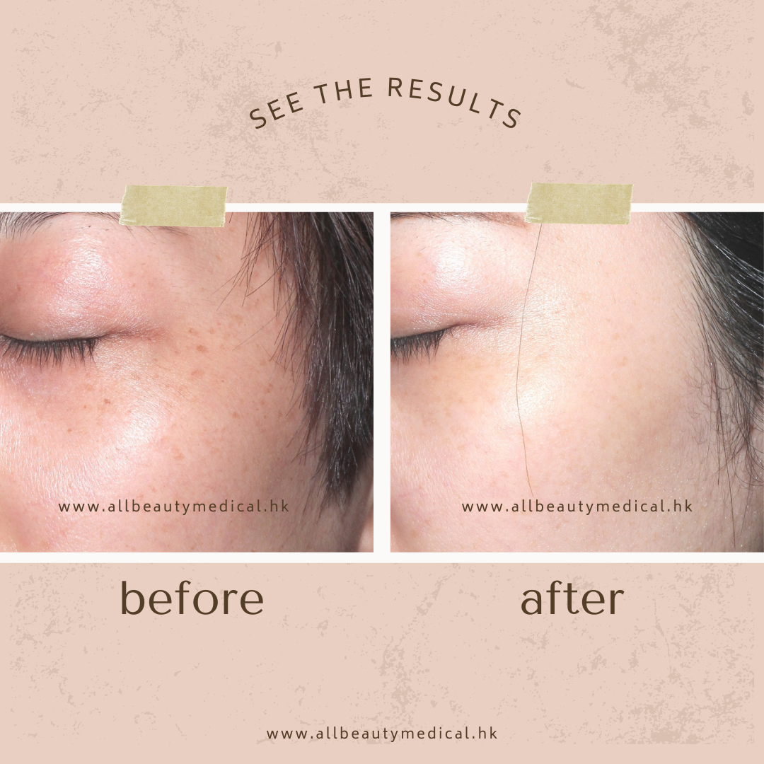 Simple Neutral Minimal Photocentric Before and After Instagram Post (1).png