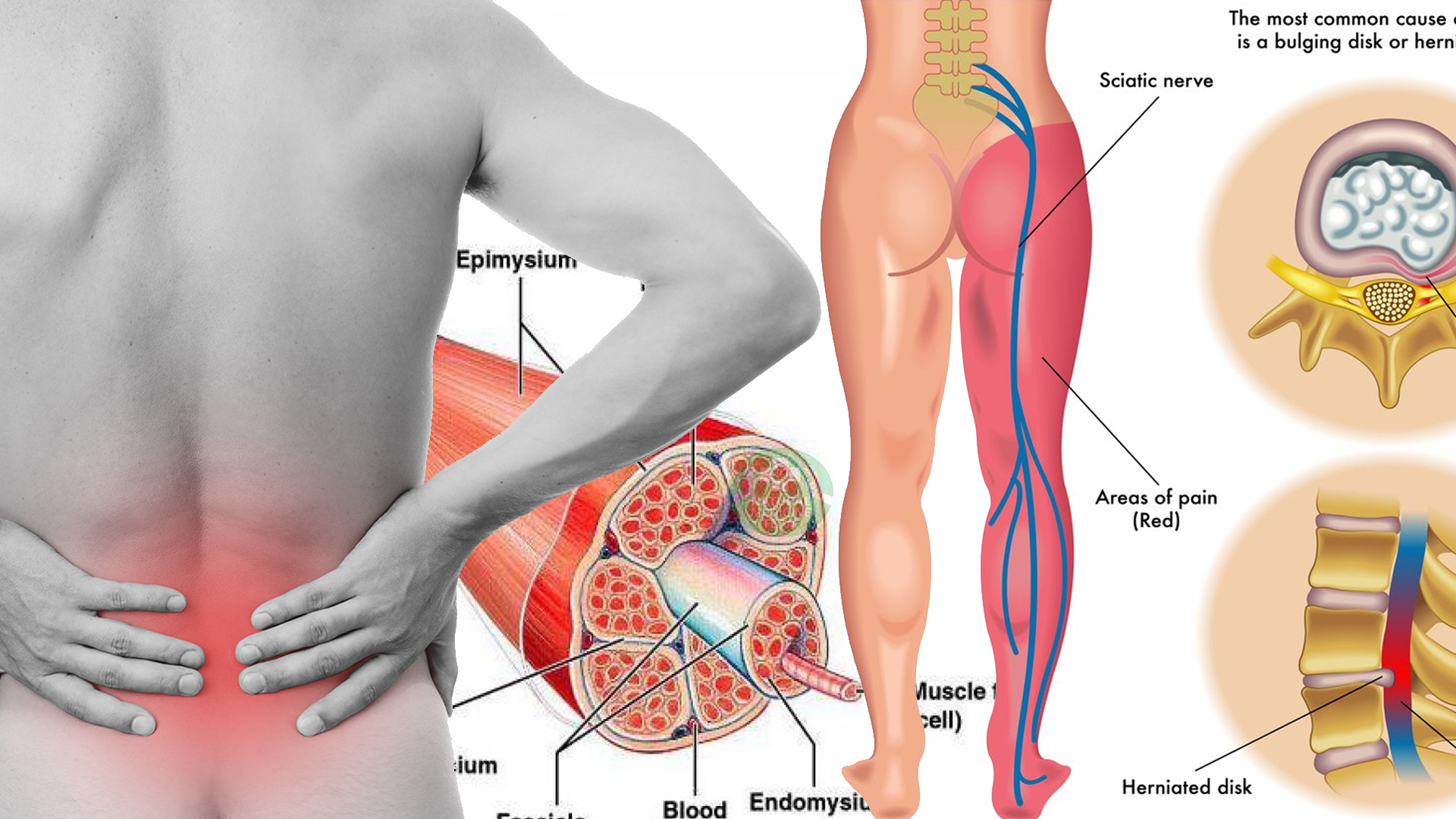 Can prostate cause leg pain Can prostate cause leg pain
