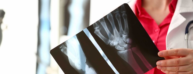 X-ray-marlet-allied-market-research.jpg