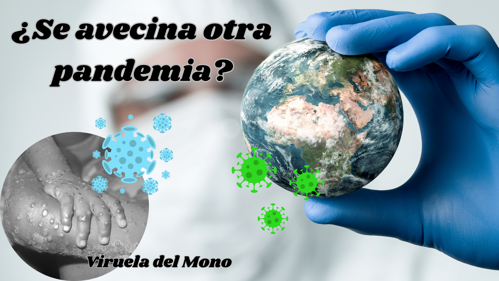 VIRUELA DEL MONO o MPOX.png