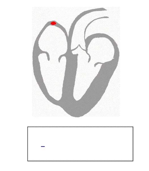 525px-ECG_principle_slow.gif
