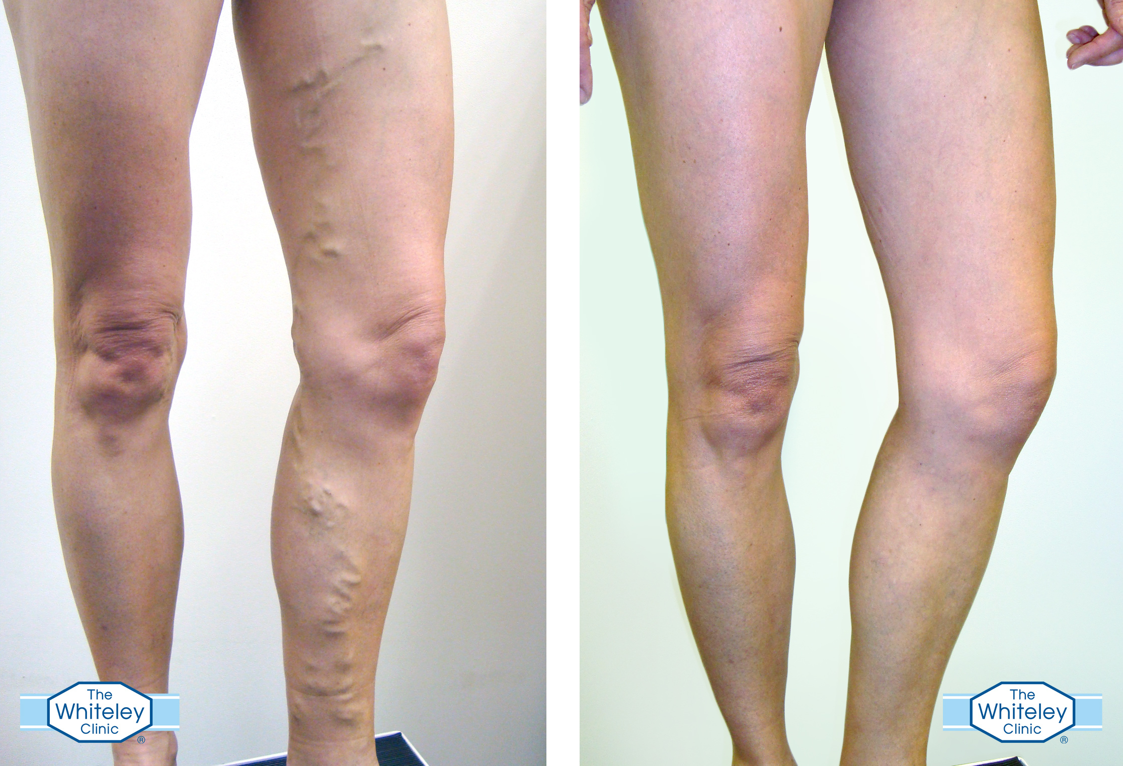 17-29-43-TWC-before-after1.jpg