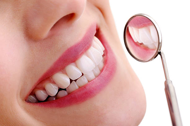 Teeth Whitening.jpg