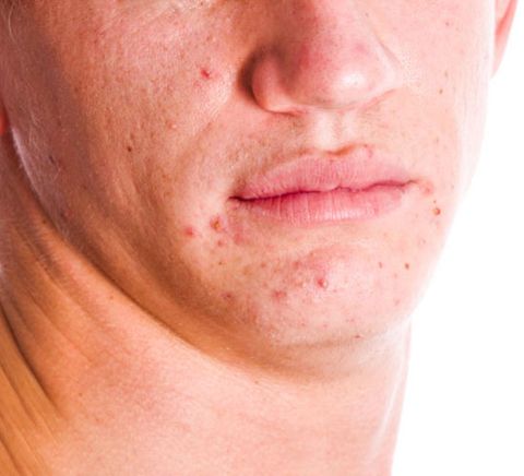 Skin-Problems.jpg