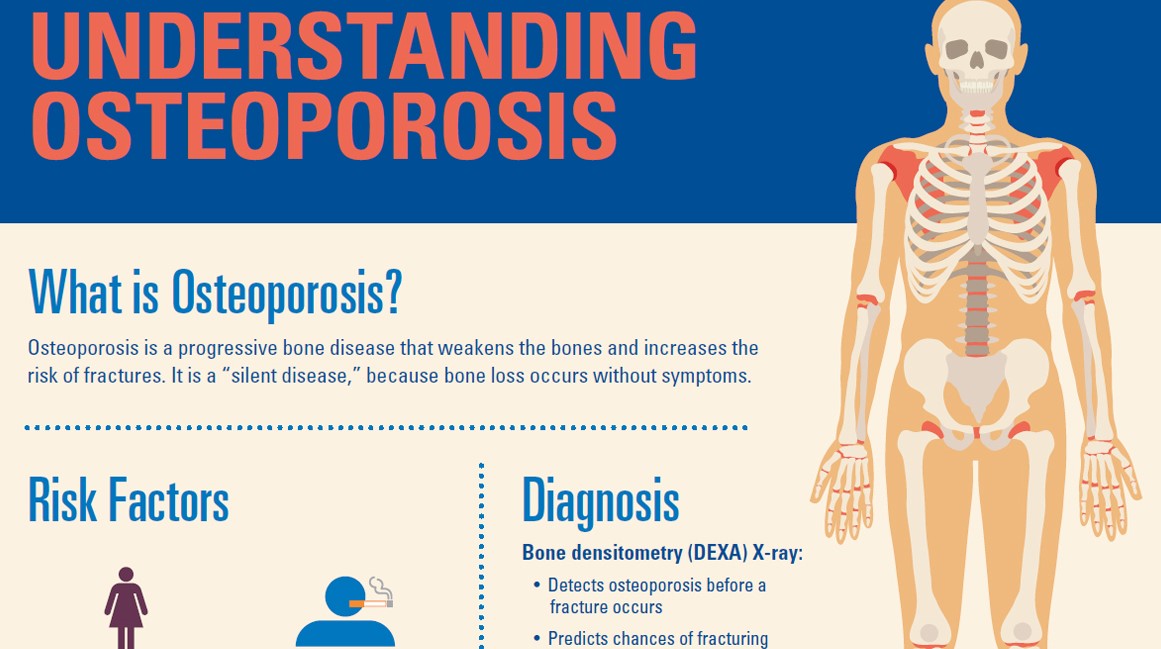 Остеопороз болят кости. Остеопороз боли. Weakening of the Bone. Book Diagnostics of Bone and.