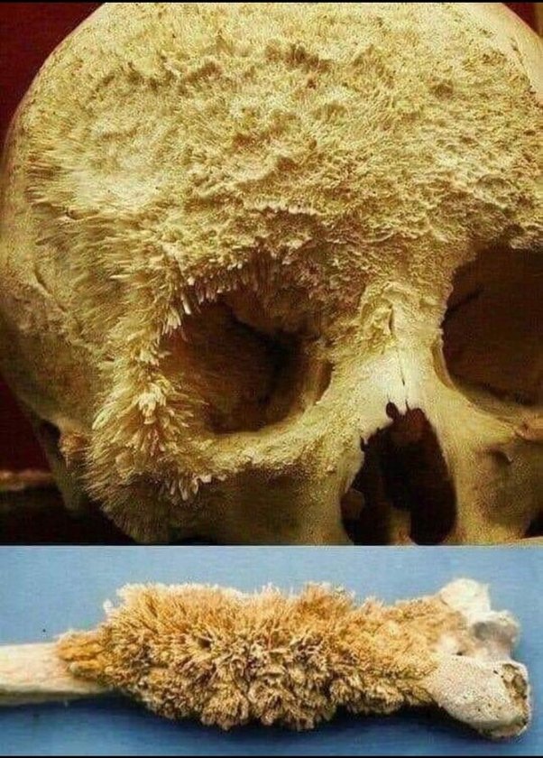 bone.jpg