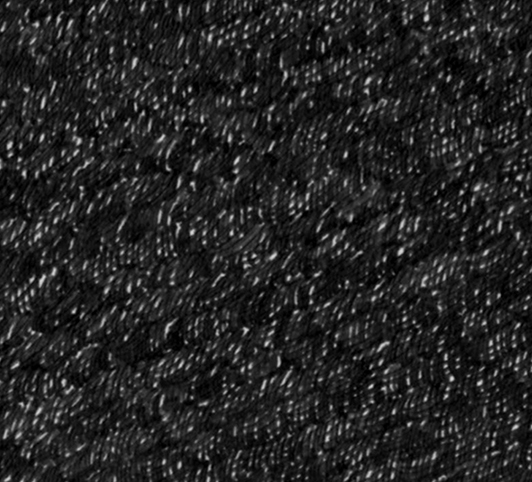 FearOfAbandonment_ASP_detail3.jpg
