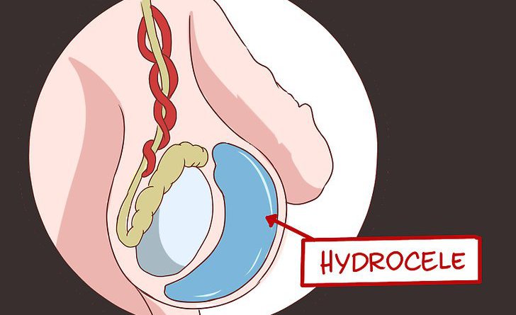 hidro1.jpg