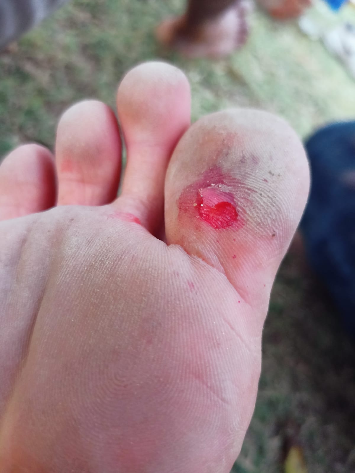 blood 2.jpg