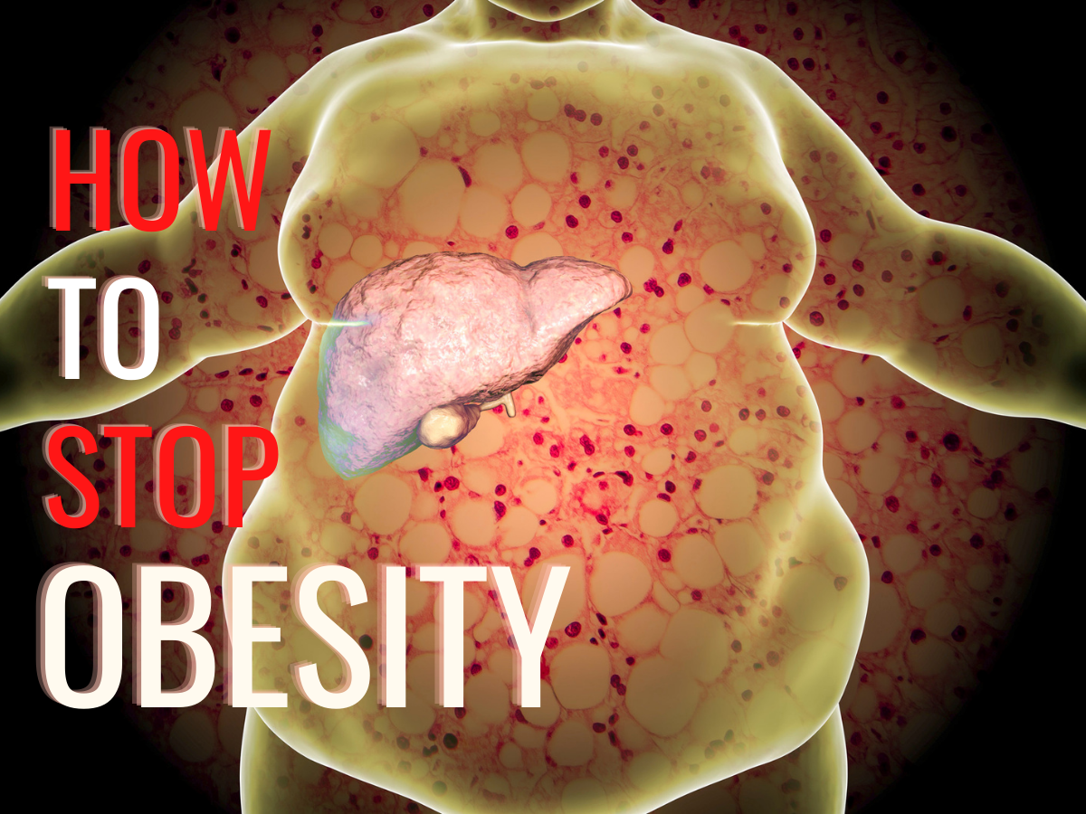 obesity.png