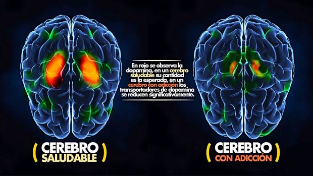 cerebro%20adicto.jpg