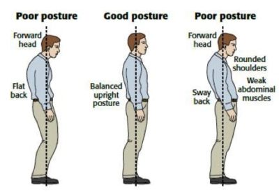 bad-posture-400x275.jpg