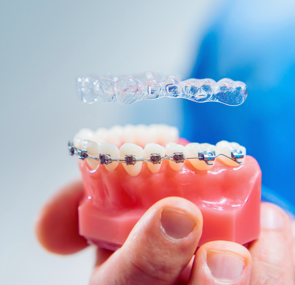 5 Weighty Reasons to Visit an Orthodontist.jpg