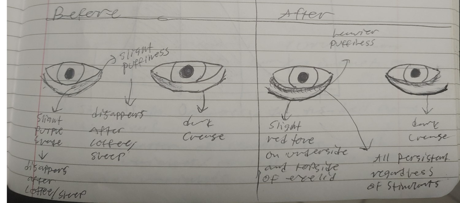 sad eyes.jpg