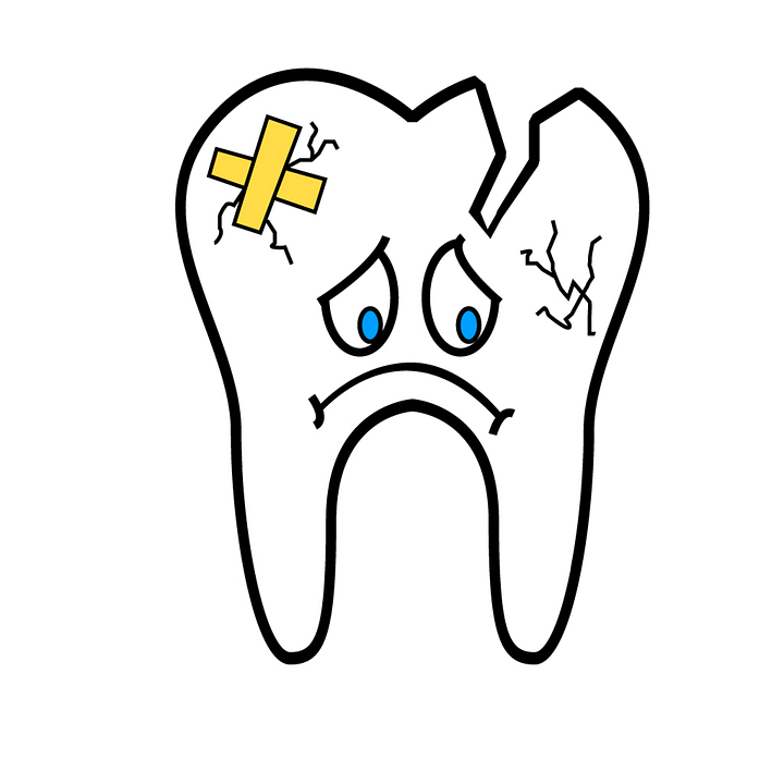 broken-tooth-2351797_960_720.png