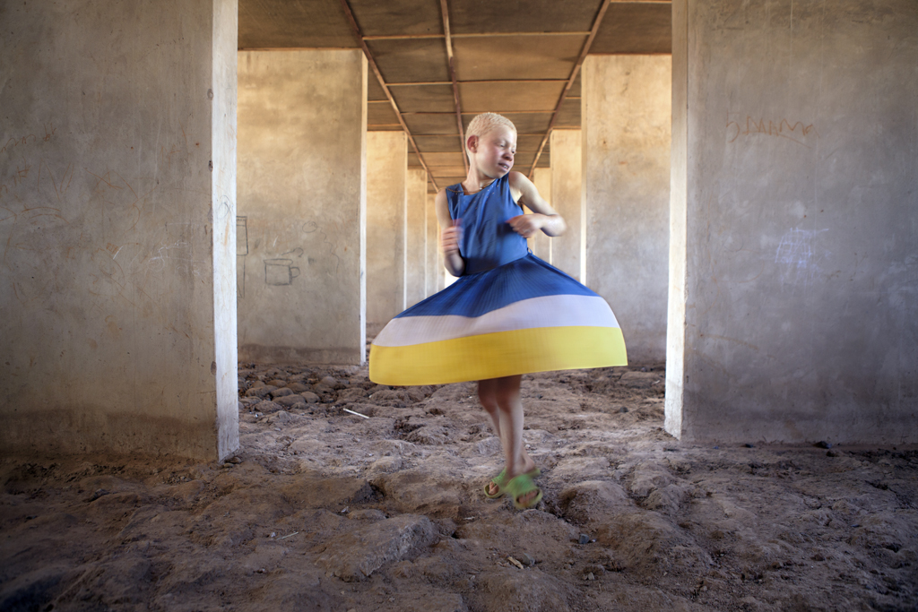 EL-BAILE-DE-KELEN.-ALBINOS-EN-TANZANIA-%C2%A9ANA-PALACIOS.jpg
