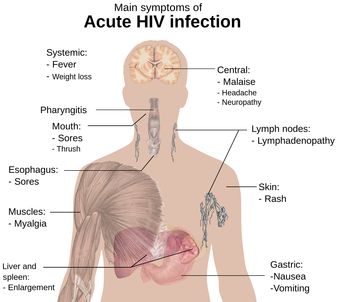 hiv-1280510_1280.png