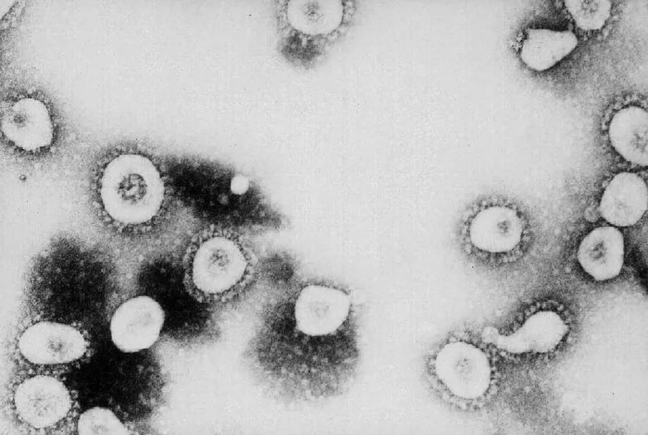 SARS CDC 1889380.jpg