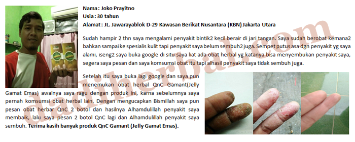 Testimoni-Bintik-Bintik-Berair.png