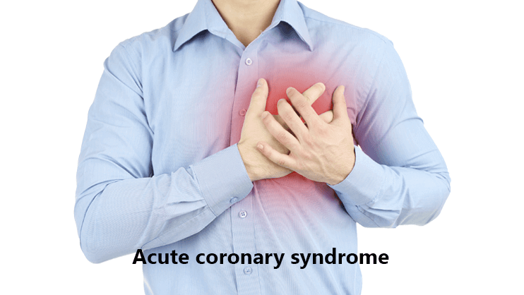 acute-coronary-syndrome.png