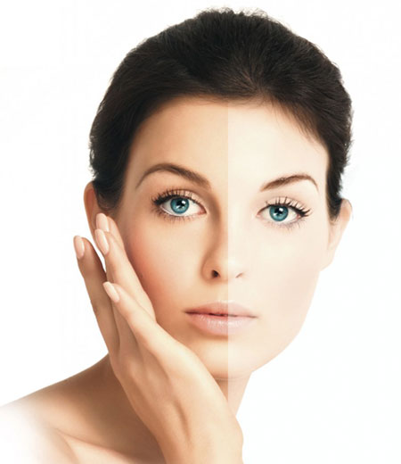Skin Whitening Treatment in Dubai.jpg
