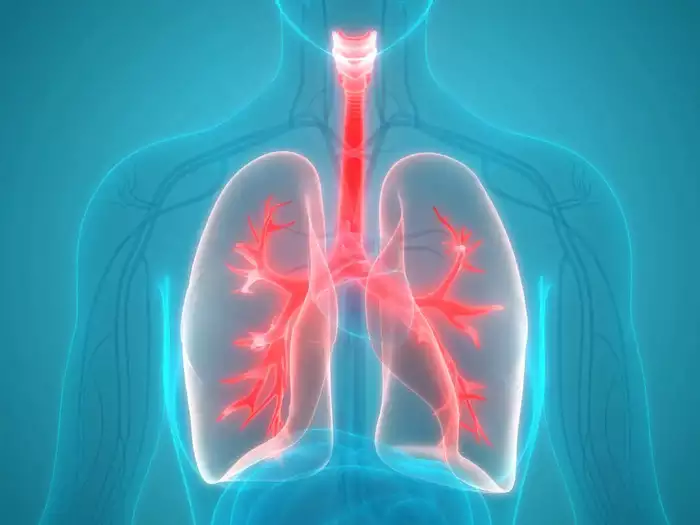 alarming-rise-in-lung-cancer-amongst-non-smokers-women-and-youngsters-study.webp