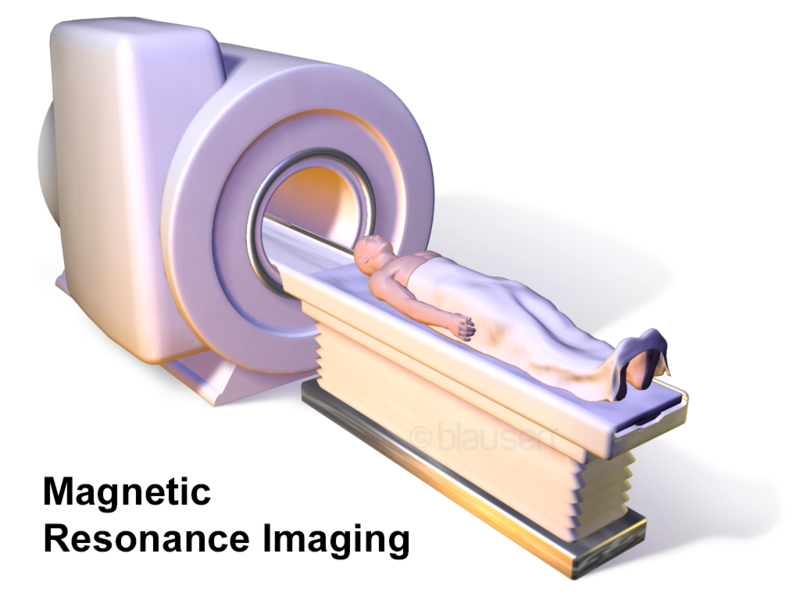 Como se hace una resonancia magnética de próstata