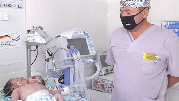 0_PAY-A-two-headed-baby-4-EAST2WEST-NEWS.jpg