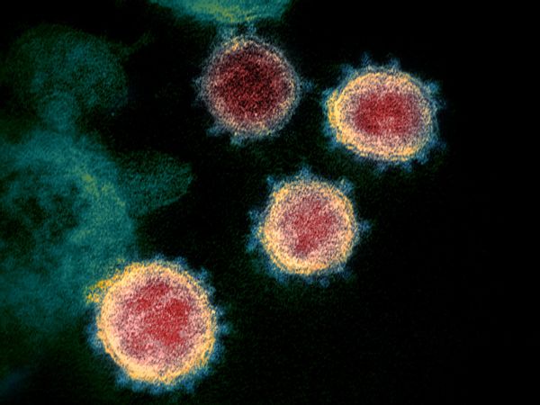 Novel_Coronavirus_SARS-CoV-2.jpg