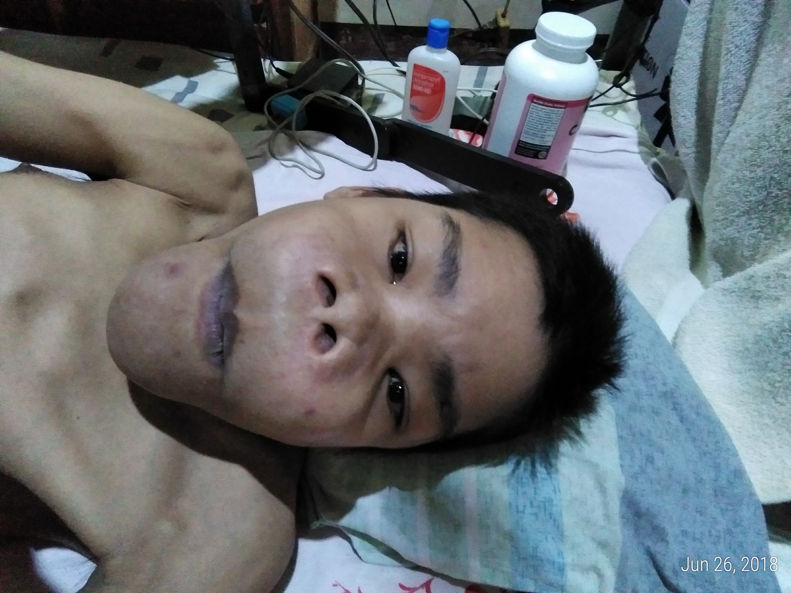 P_20180626_100049_p.jpg