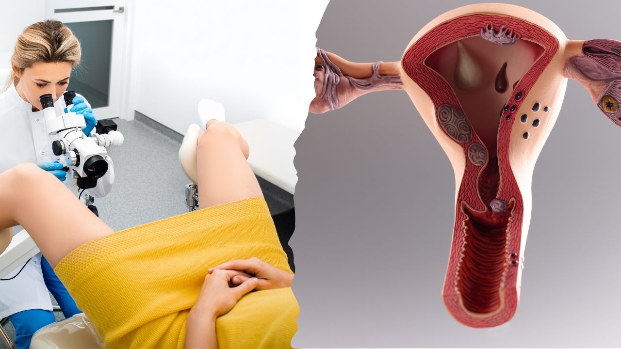 Will You Be Able to Become Pregnant With Uterine Fibroids.jpg
