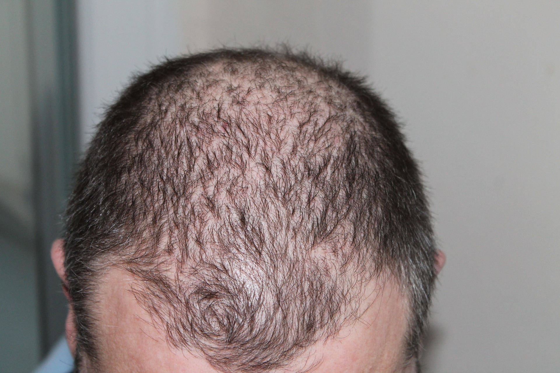 hair-248050_1920.jpg