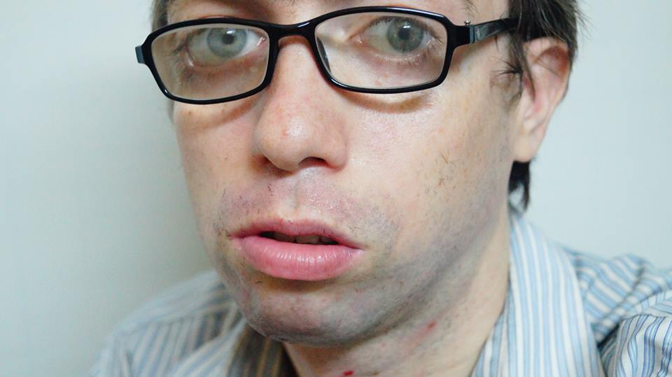 2015-07-04 - Saturday - 09:07 AM - Forever Alone Joey.jpg