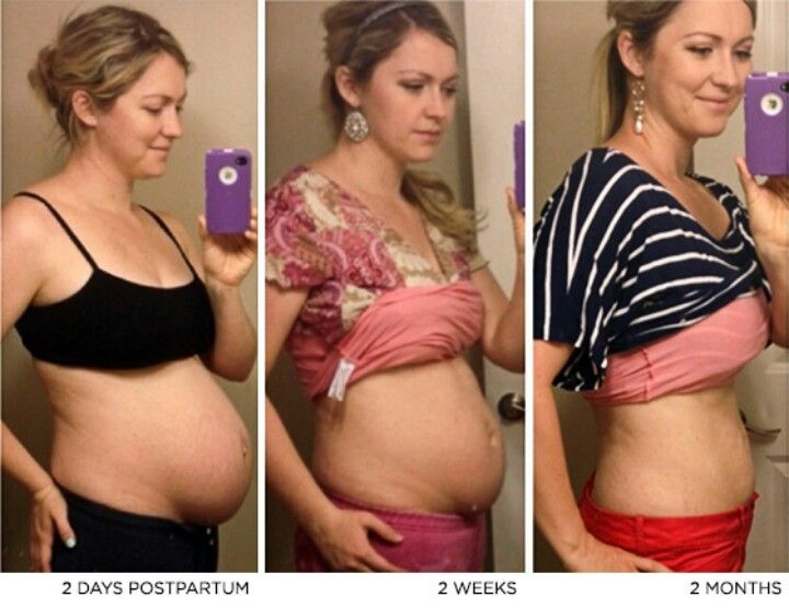 1 неделя после родов. Тело до и после беременности. Женщины до и после родов. Живот до и после рождения ребенка. Тело женщины после беременности.