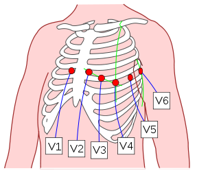 287px-Precordial_Leads_2.svg.png