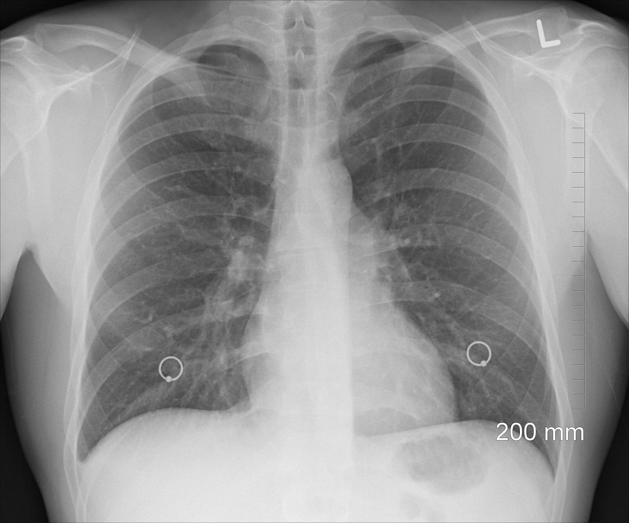 diagnosis-1476620_1280.jpg