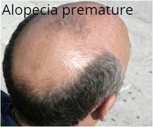 hair-loss (1).jpg