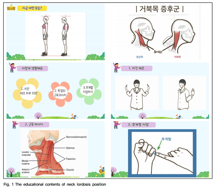 거북목2.png