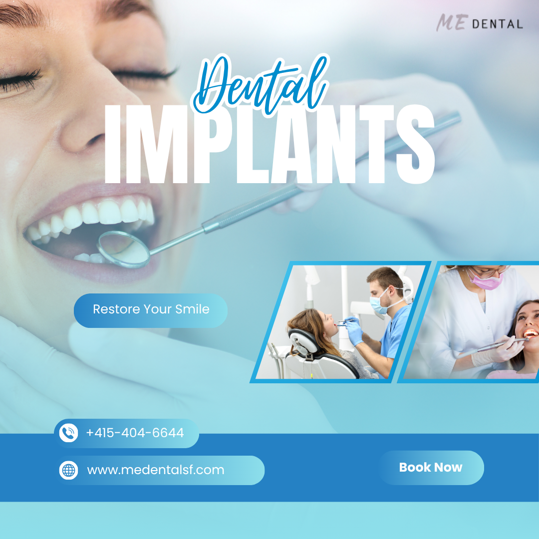 Dental implants.png