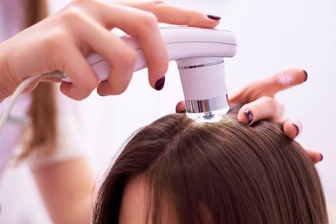 scalp_treatment_in_Raleigh.jpg