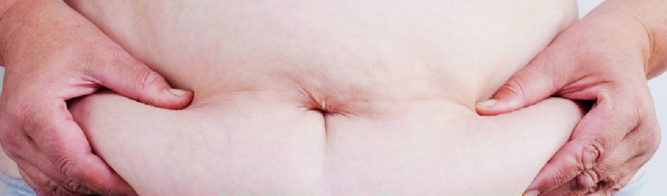 How can we reduce the risk of developing obesity.jpg