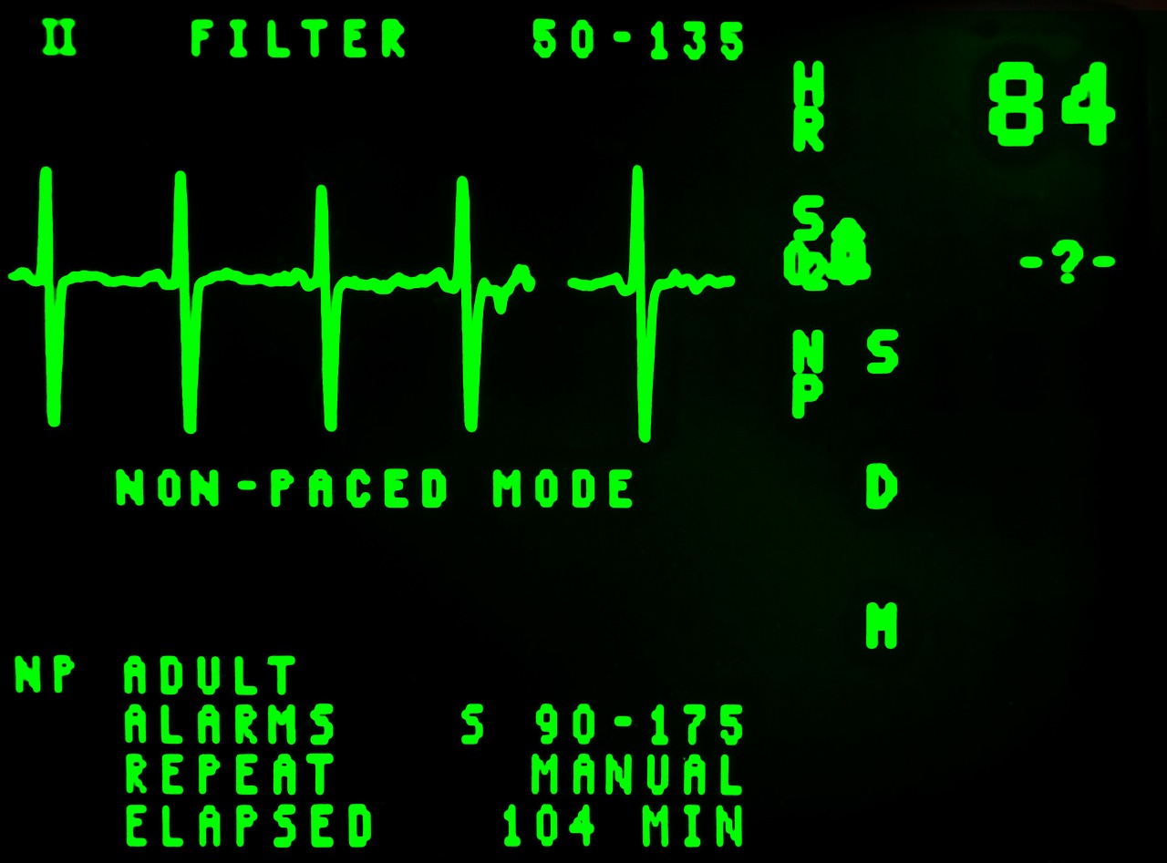 electrocardiogram-16948_1280.jpg