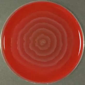 Proteus-mirabilis-in-blood-agar.webp